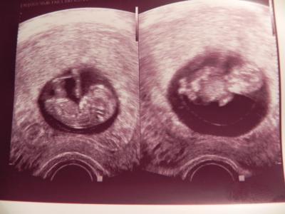 Bild zu Zurück vom FA :-) - Forum für November - Mamis
