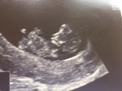 Bild zu geburtsanmeldung - Forum für November - Mamis