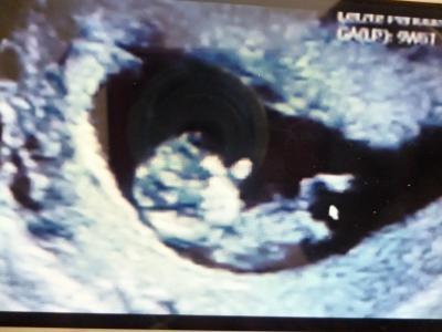 Bild zu Ich war beim FA! - Forum für November - Mamis