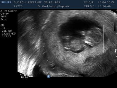 Bild zu FA Bericht :) - Forum für November - Mamis