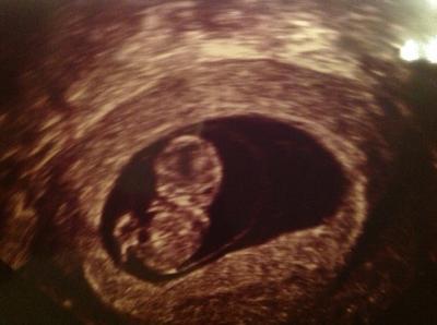 Bild zu FA-Termin mit Bildchen 8+6 - Forum für November - Mamis