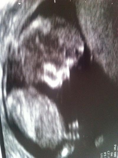 Bild zu Zurück vom FA. - Forum für November - Mamis