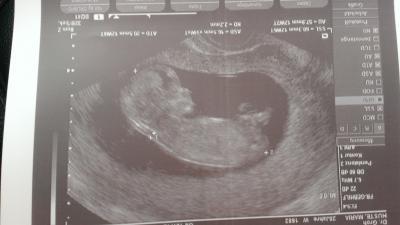 Bild zu ich will auch mal mit nem Bildchen glänzen - Forum für November - Mamis
