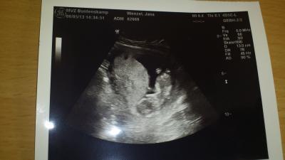 Bild zu FA-Termin - Forum für November - Mamis