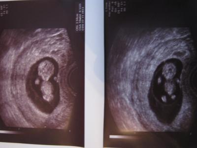Bild zu Babyfotos :)) - Forum für November - Mamis