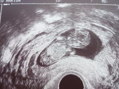 Bild zu us Bild - Forum für November - Mamis