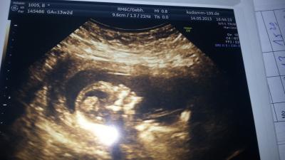 Bild zu zurück von der frühdiagnostik mit outing - Forum für November - Mamis