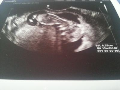 Bild zu FA Bericht - Forum für November - Mamis