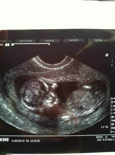 Bild zu zurück vom FA... - Forum für November - Mamis