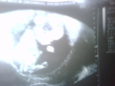 Bild zu Sachen kaufen erst ab... - Forum für November - Mamis