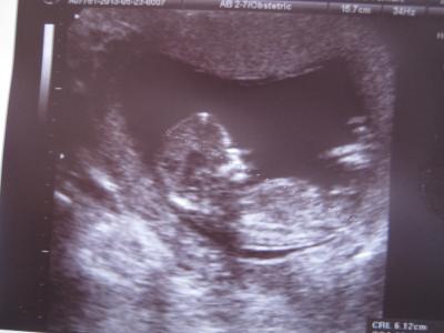 Bild zu Babyfoto :) - Forum für November - Mamis