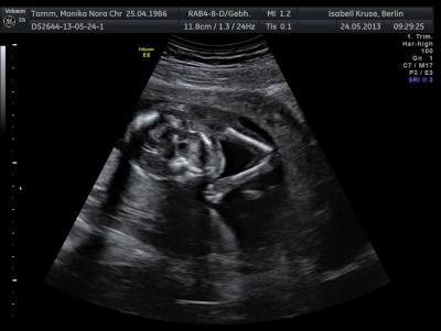 Bild zu 17+5 und Murmelchen hat sich versteckt... - Forum für November - Mamis