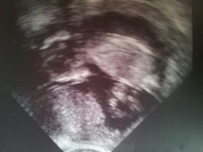 Bild zu bericht vom gyn gestern - Forum für November - Mamis