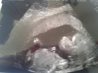 Bild zu FA termin und outing - Forum für November - Mamis