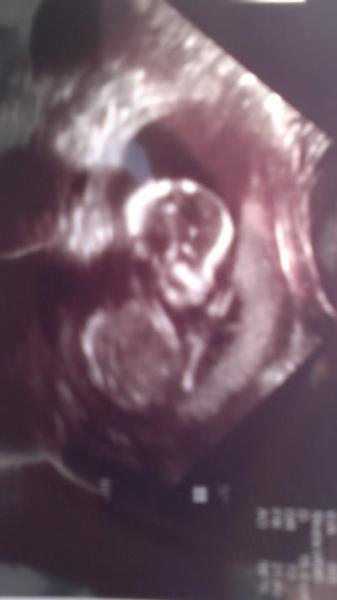 Bild zu Fa Bericht und etwas traurig - Forum für November - Mamis