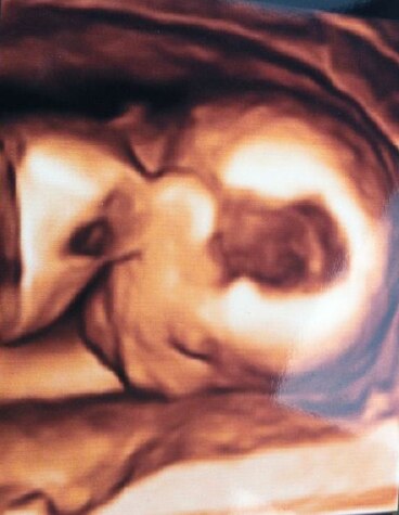 Bild zu FA Bericht - Forum für November - Mamis