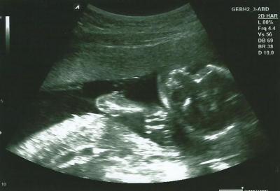 Bild zu FA Bericht - Forum für November - Mamis