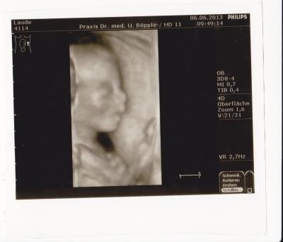 Bild zu heute FA Termin gehabt... - Forum für November - Mamis