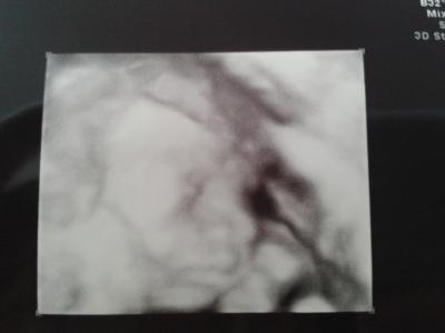 Bild zu zurück von feindiagnostik - Forum für November - Mamis