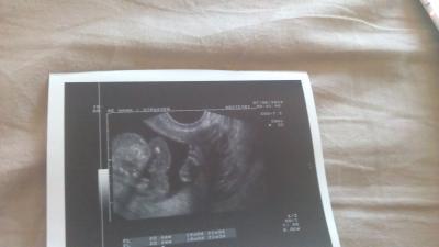 Bild zu Zurück vom Fa mit Outing - Forum für November - Mamis