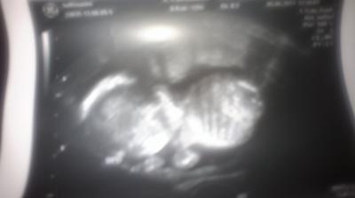 Bild zu Ein freundliches Hallo- nehmt ihr mich noch auf?? - Forum für November - Mamis