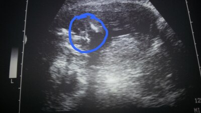 Bild zu zurück vom FA-termin - Forum für November - Mamis