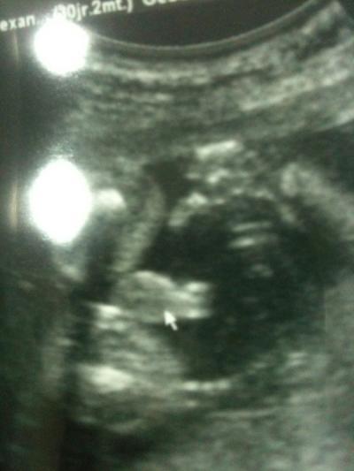 Bild zu Outing - Forum für November - Mamis