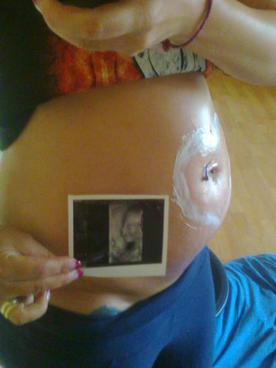 Bild zu Vorderwandplazenta????? - Forum für November - Mamis