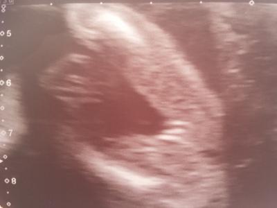 Bild zu Dann will ich mich auch mal outen :-) - Forum für November - Mamis