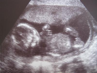 Bild zu Auch zurück :) - Forum für November - Mamis