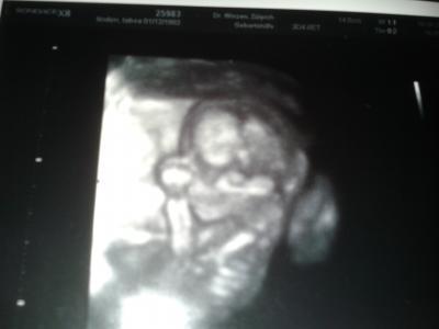 Bild zu zurück von FA mit 100 % tigen outing - Forum für November - Mamis