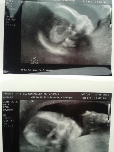 Bild zu Bild vom Zwerg - Forum für November - Mamis