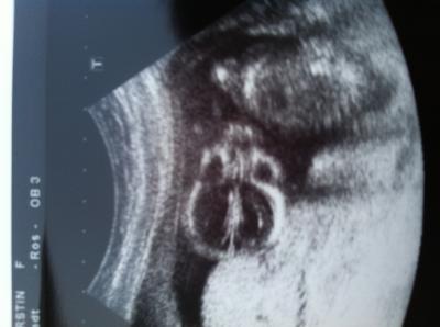 Bild zu FA Bericht von gestern... - Forum für November - Mamis