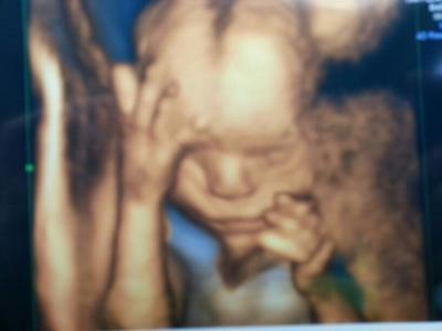 Bild zu bin zurück - Forum für November - Mamis