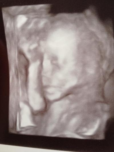 Bild zu War beim Fa, Organscreening - Forum für November - Mamis