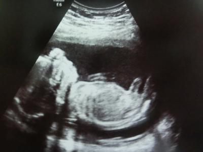 Bild zu Kein Outing, dafür 'ne Schätzung =D - Forum für November - Mamis