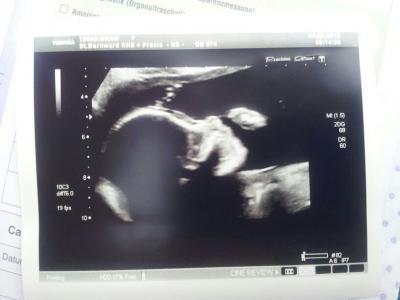 Bild zu Feindiagnostik + Outing + Name + Babybauchbild + Entschuldigung - Forum für November - Mamis