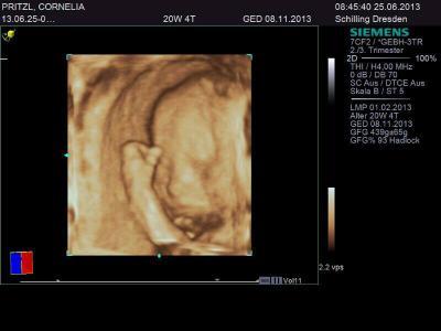 Bild zu Feindiagnostik - Forum für November - Mamis