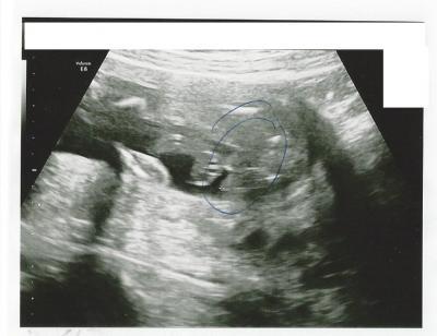 Bild zu Junge oder Mädchen? Könnt Ihr was erkennen? - Forum für November - Mamis