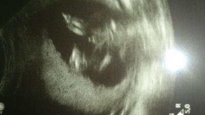 Bild zu frauenarzt Bericht und outing - Forum für November - Mamis