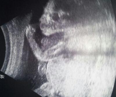 Bild zu us bild - Forum für November - Mamis