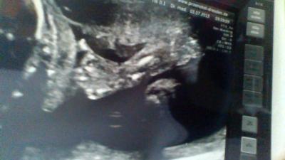 Bild zu FD-Ergebniss - Forum für November - Mamis