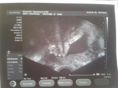 Bild zu zurück vom fa :-) - Forum für November - Mamis