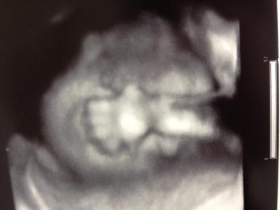 Bild zu Zurück vom FA inkl. Zuckertest - Forum für November - Mamis