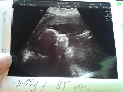 Bild zu FA Bericht + Foto - Forum für November - Mamis