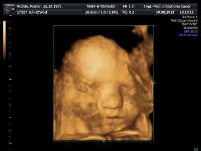Bild zu 3D Ultraschall - Forum für November - Mamis