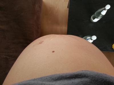 Bild zu also ich kann meine Füße nicht mehr sehen - Forum für November - Mamis