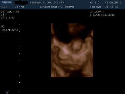 Bild zu Zurück vom FA. Endlich 3D Bild - Forum für November - Mamis