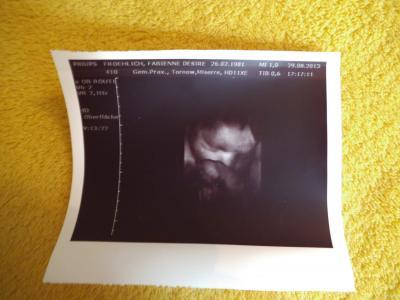 Bild zu 3. Ultraschalscreening mit 3D-Bildchen - Forum für November - Mamis