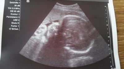 Bild zu Termin beim Arzt und Bild - Forum für November - Mamis